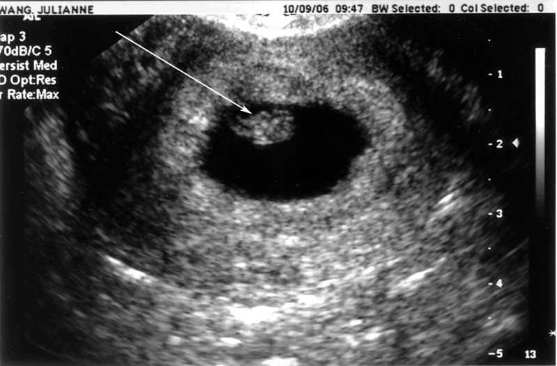 Ultrasound10-09-06