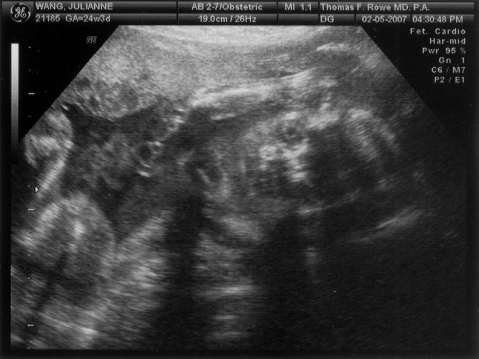 Ultrasound02-05-07