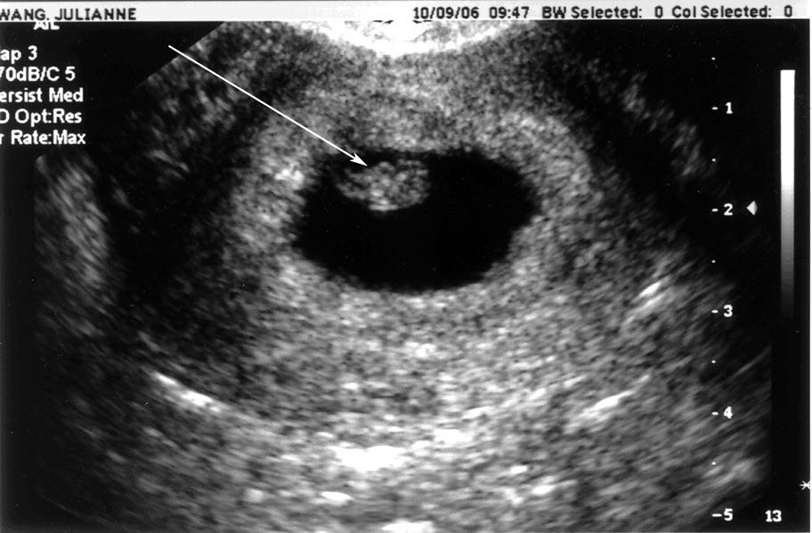 Ultrasound10-09-06